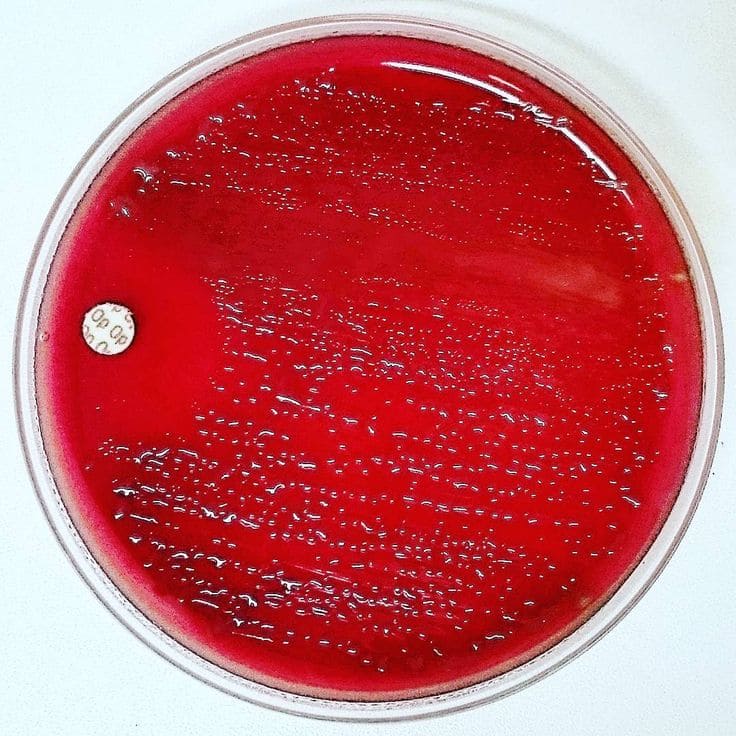 Rezisztencia termék 01