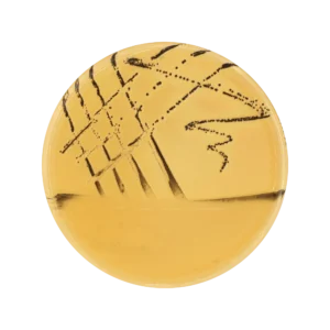 Salmonella Shigella (SS) Agar