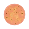 Salmonella Shigella (SS) Agar