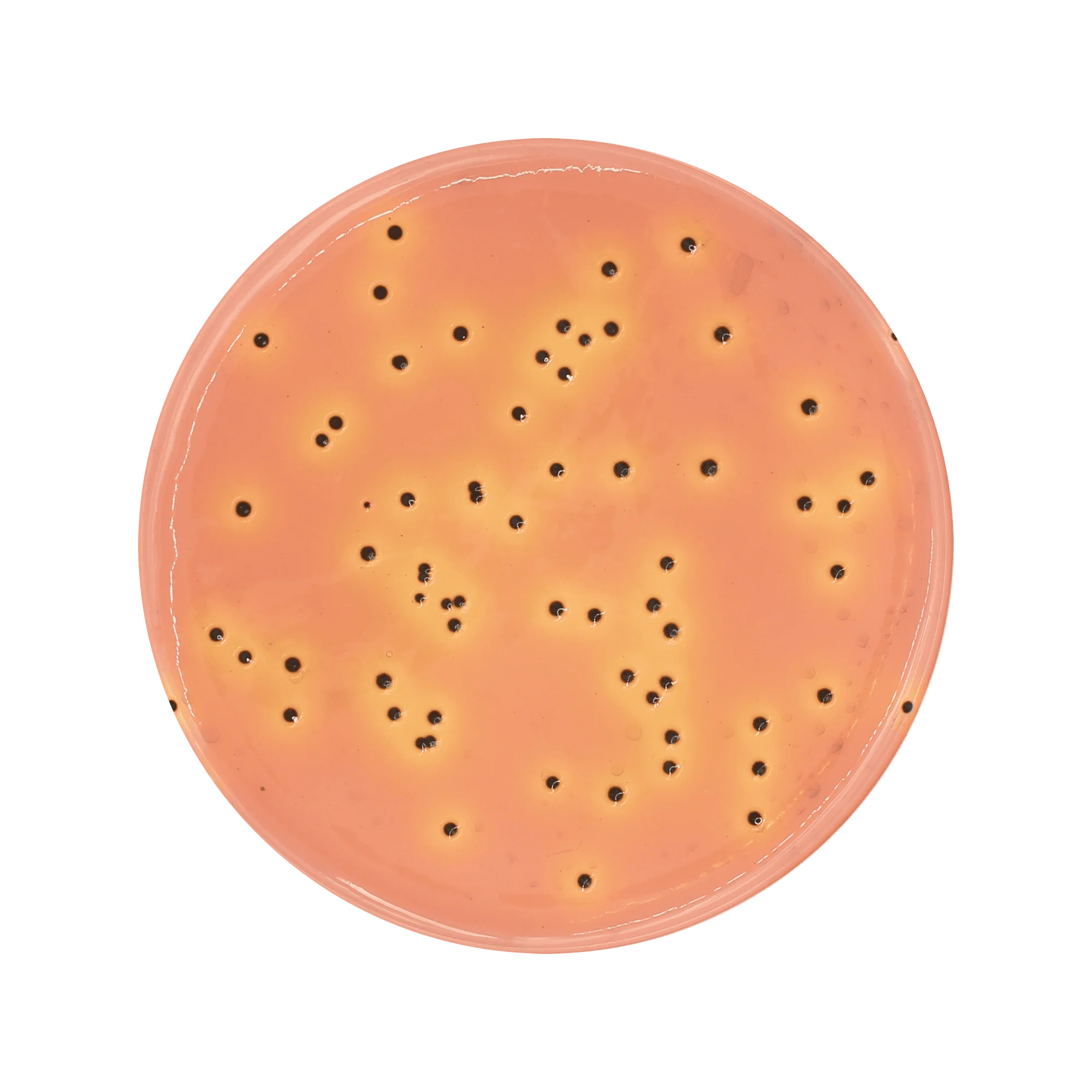 Salmonella Shigella (SS) Agar